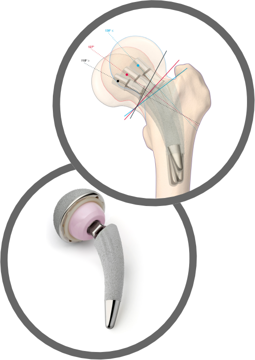 Hüftgelenk Hüftgelenk